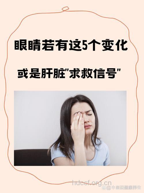 警惕眼睛里的肝病信号