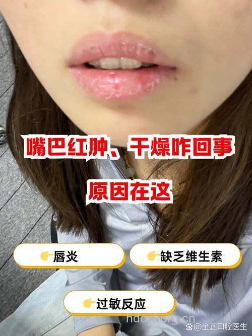 频繁用口红可导致胃癌