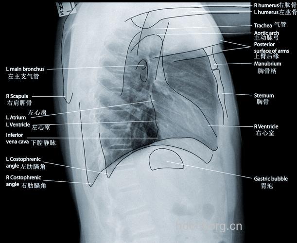 您看得懂胸片吗？
