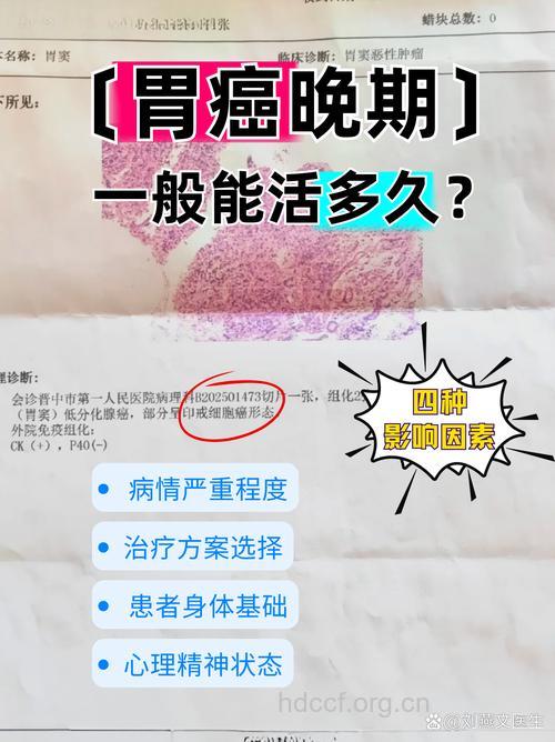 胃癌晚期患者还能活多久