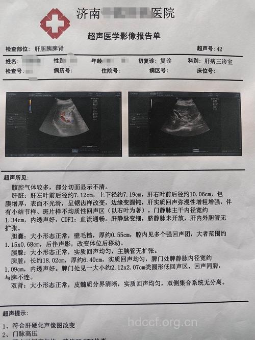 从肝脏多普勒检查结果看疾病