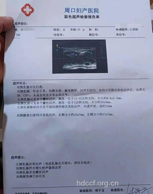 如何看乳腺彩色B超报告?