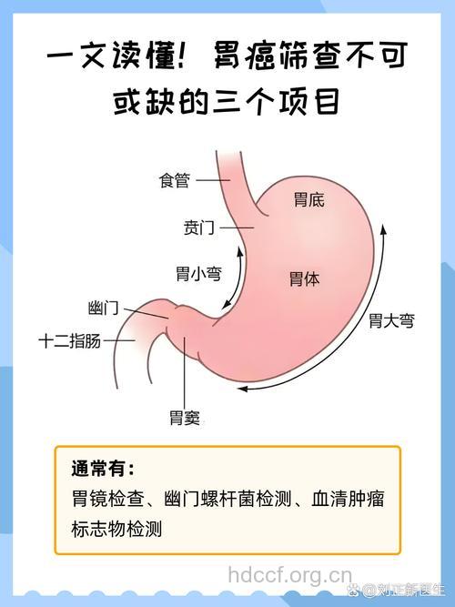胃癌有哪些诊断项目