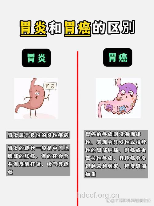 胃癌与胃炎的区别在哪里