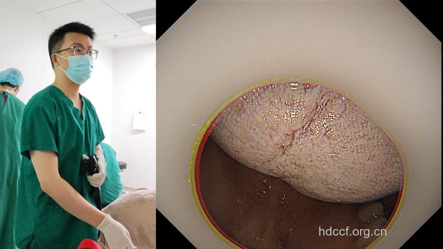 糖尿病患者慎做胃镜等检查