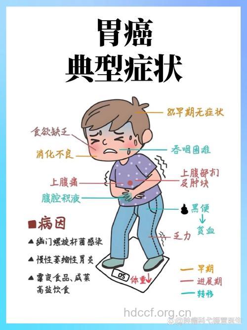 胃癌的早期有哪些症状呢