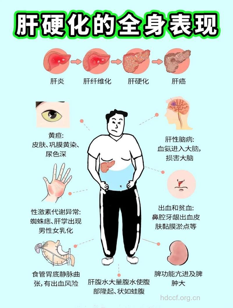 身体疲倦是肝硬化的症状吗