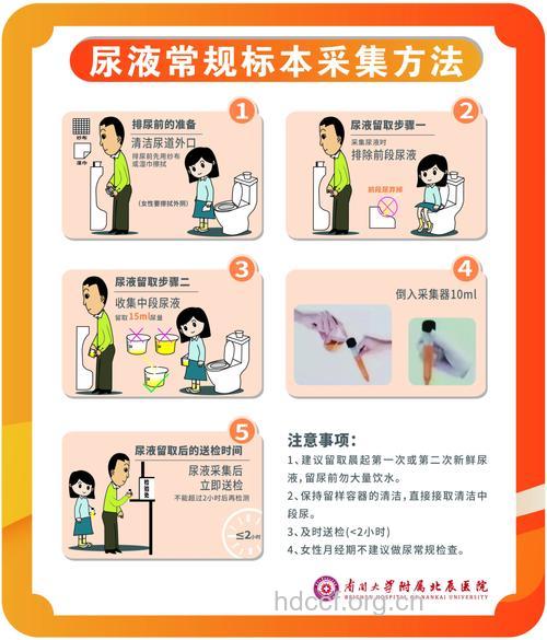 尿检时 取尿液的一些注意事项