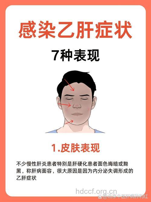 乙肝患者出现什么症状