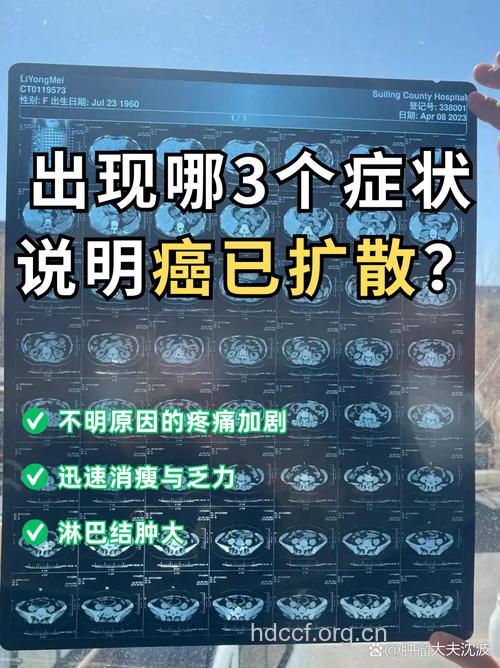 肝癌癌细胞扩散的症状有哪些