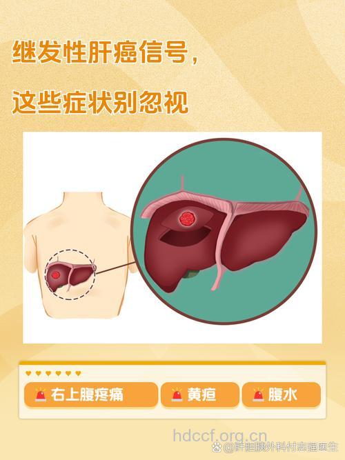 继发性肝癌有哪些症状