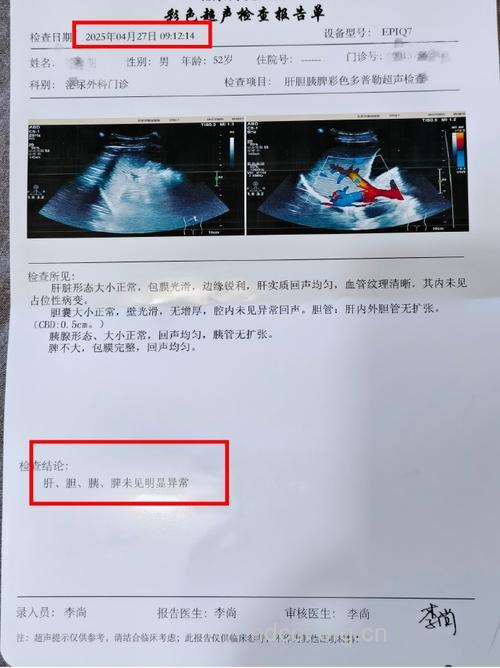 体检查出脂肪肝 无缘公务员