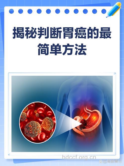 怎么辩证治疗胃癌方法