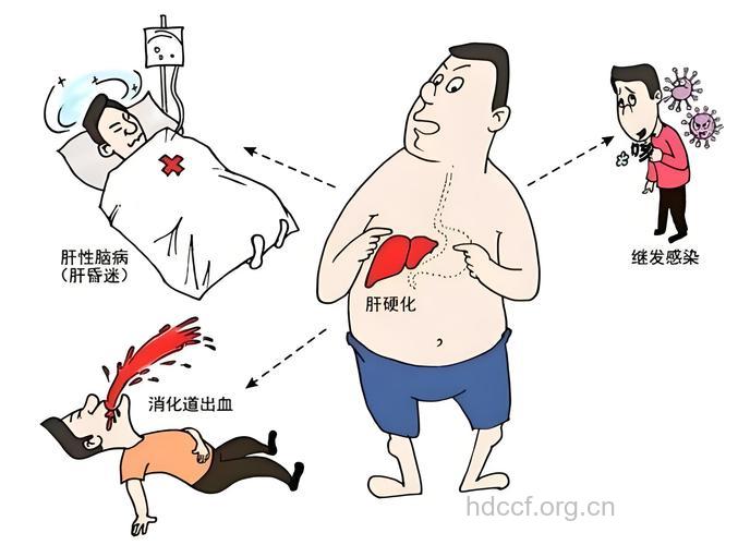 肝昏迷症状有哪些呢