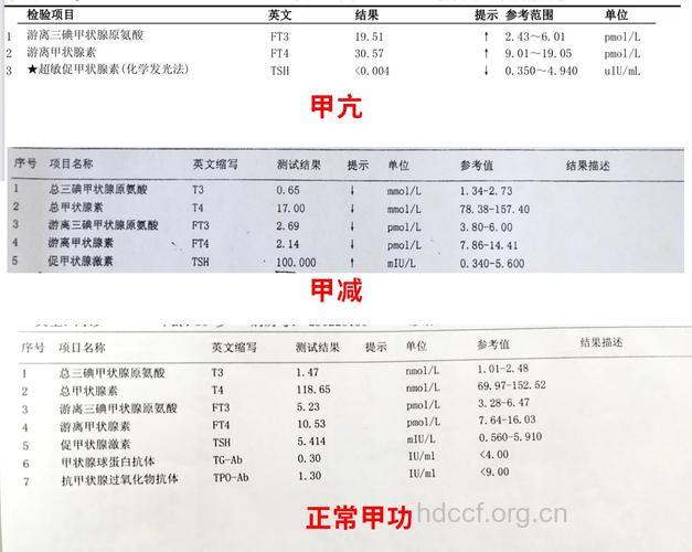 甲状腺功能全套可以检查什么