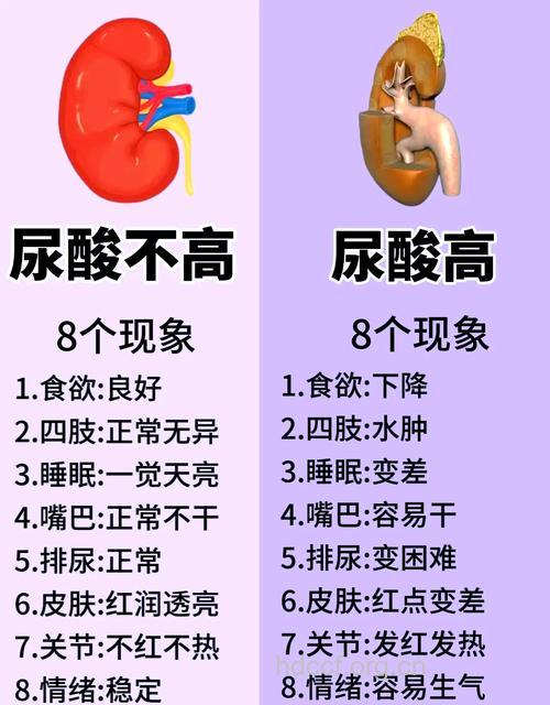 尿酸高最可能是什么病