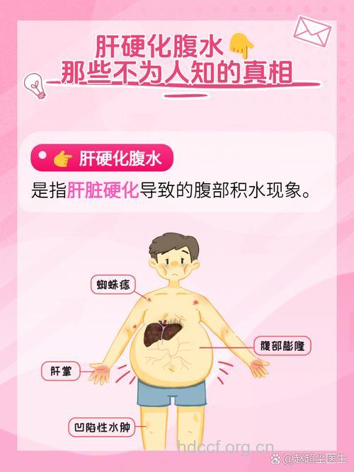 肝硬化怎么发现早期肝腹水