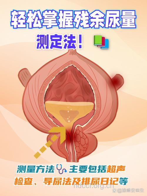 如何保证尿液检查准确性