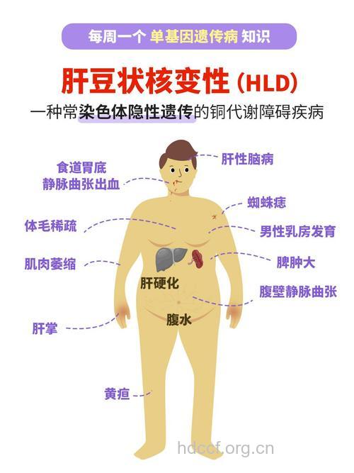 肝豆状核变性有哪些临床表现