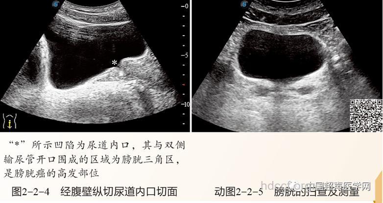 做B超前需要注意哪些问题