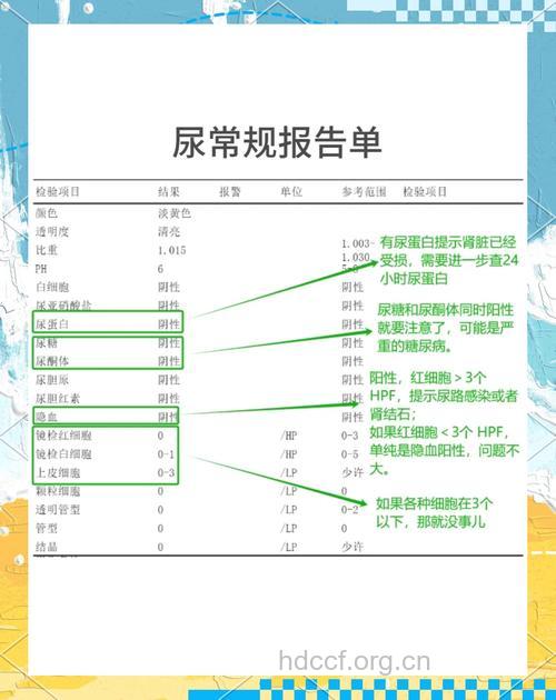 怎么进行尿常规检查