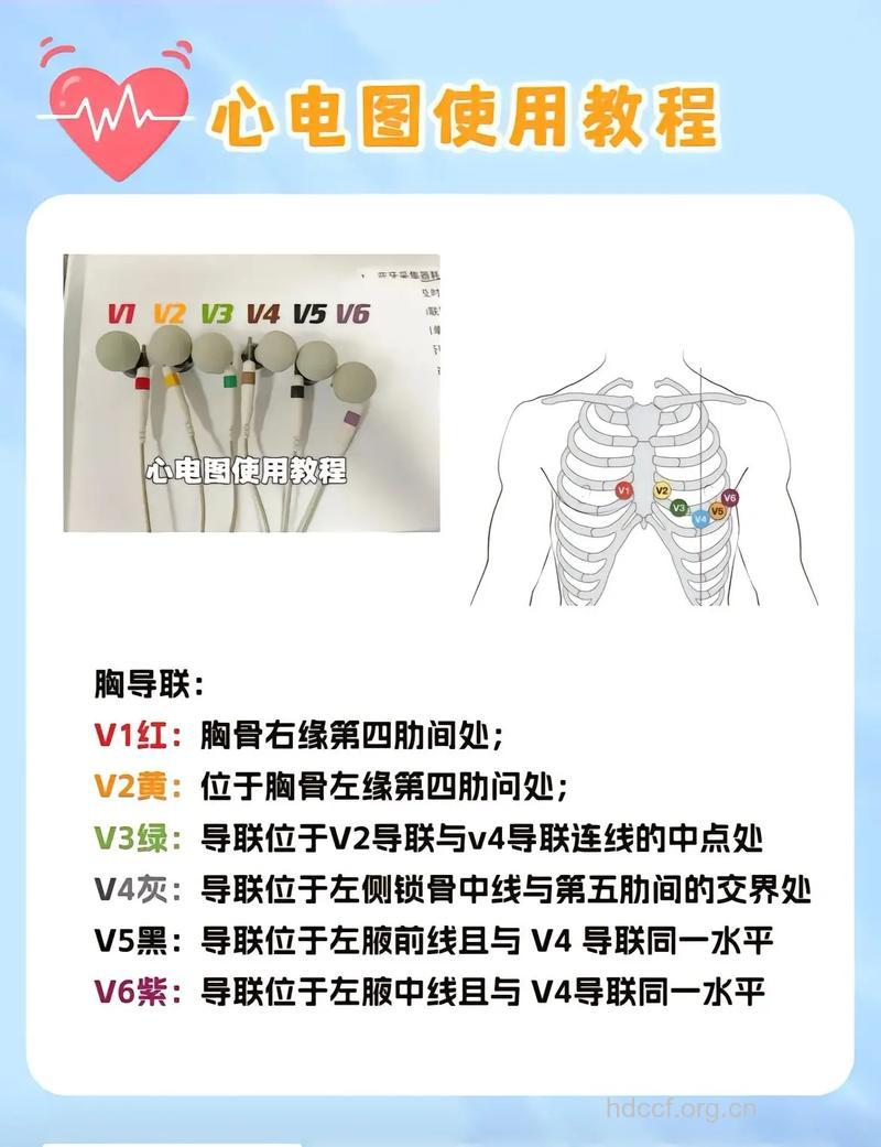 怎么进行心电图检查方法