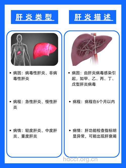 急性肝炎的症状怎么分类