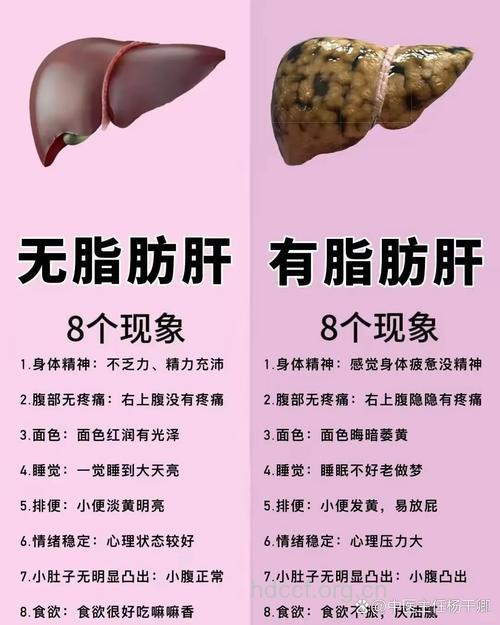 脂肪肝的症状有哪些呢