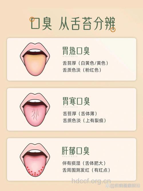 口臭是肝病的症状吗