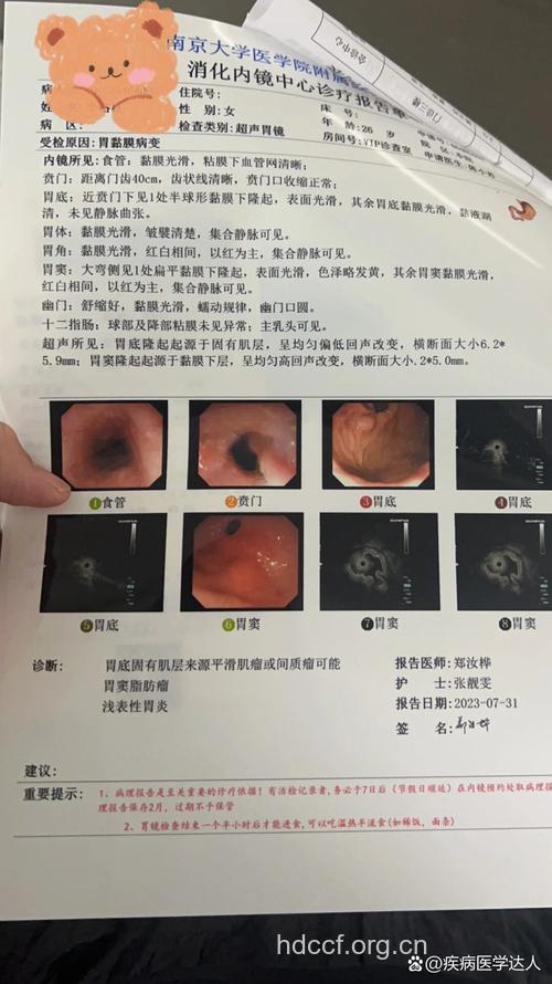 胃平滑肿瘤有哪些诊治方法
