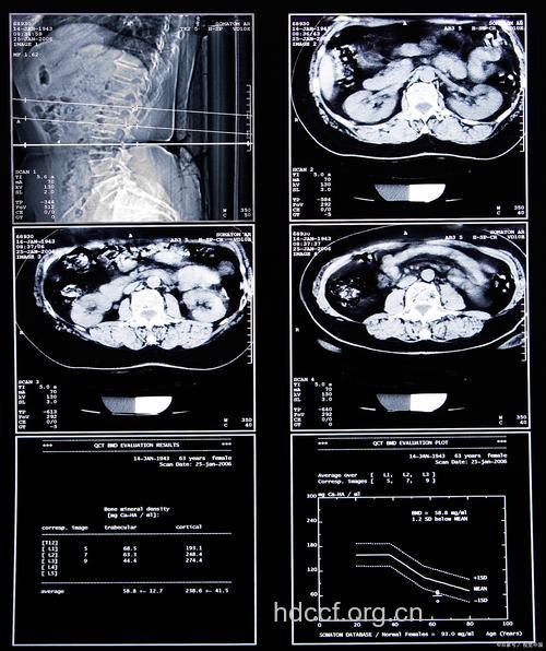 CT检查使某些病变显示更清楚