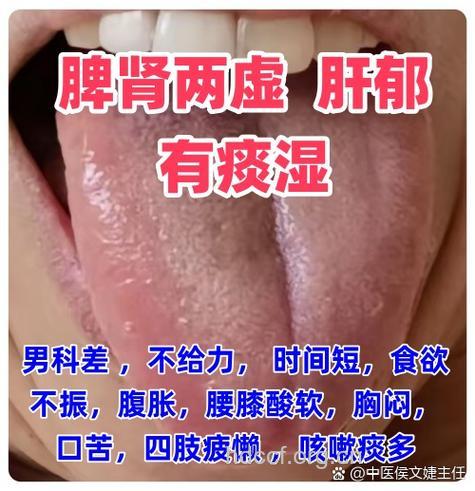 小三阳患者为何怕吃油腻
