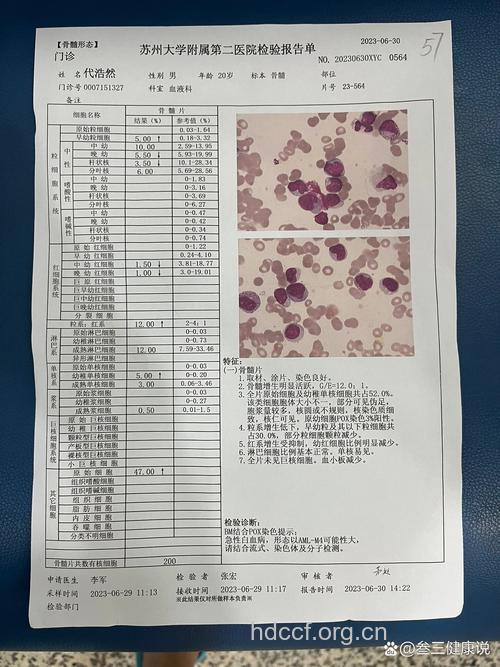 白血病人体检手册