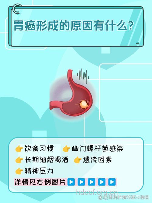 口味重易患胃癌是为什么呢