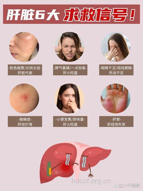 自身免疫性肝炎的表现