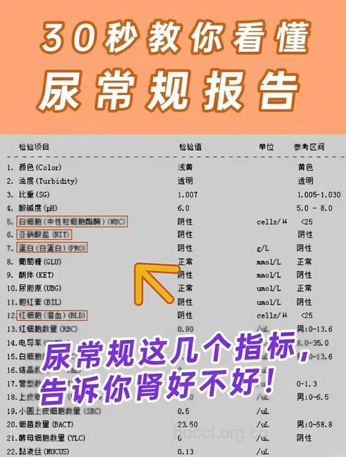 尿常规检查包含哪些内容