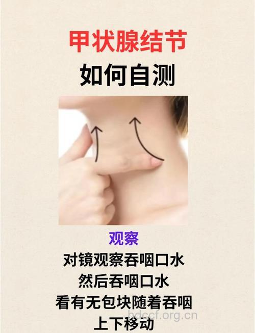 甲状腺结节要怎么检查