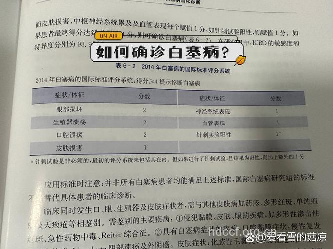 白塞氏病的检查项目