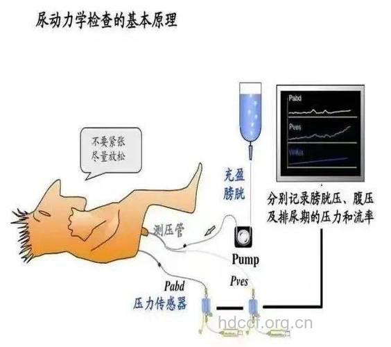 什么是尿动力学检查