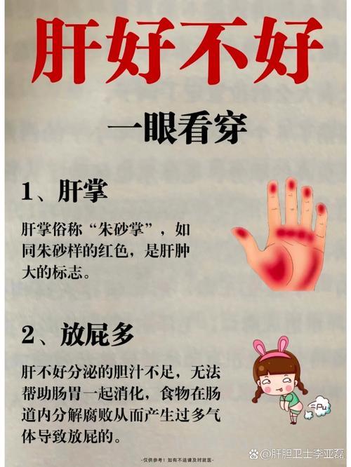 肝病患者这几条是“铁律”绝不能丢！