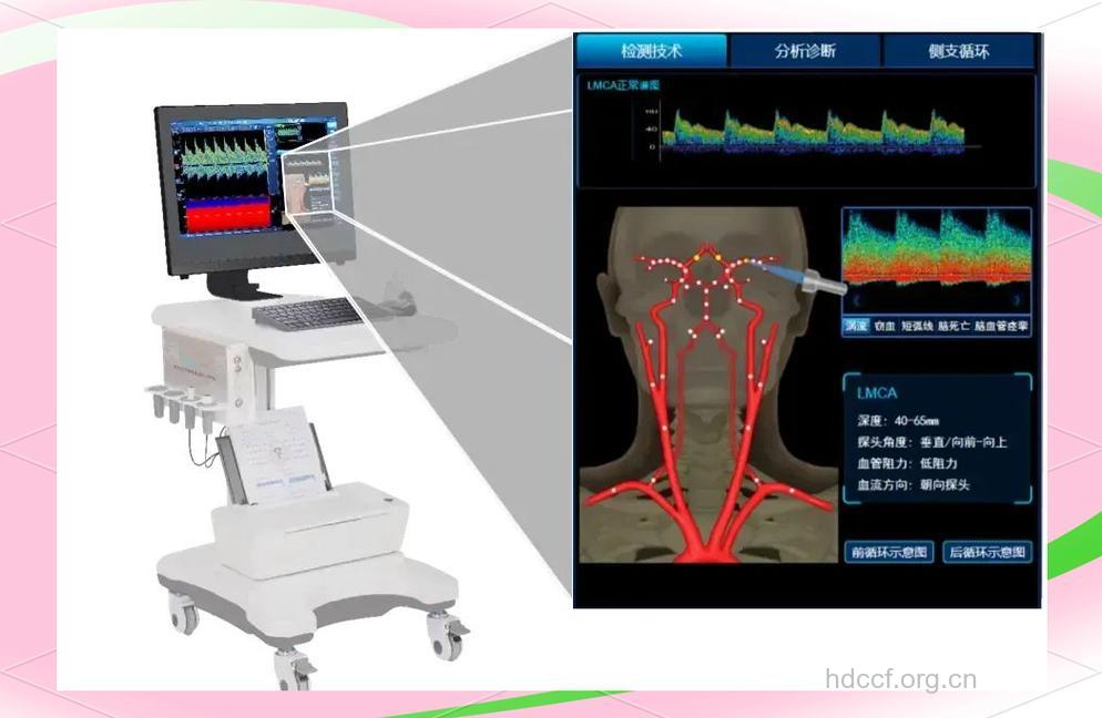 怎么进行脑血管超声检查