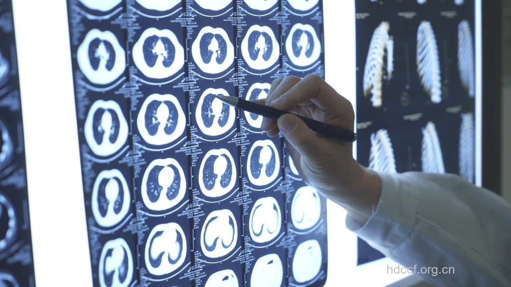 有哪些常见影像学检查