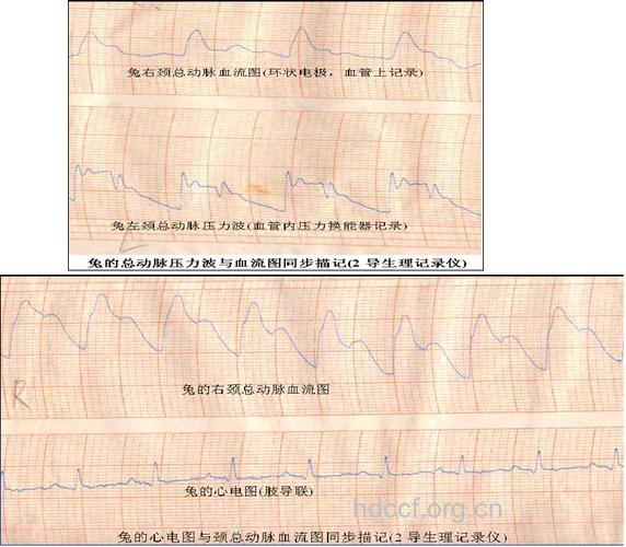 怎么进行脑阻抗血流图检查