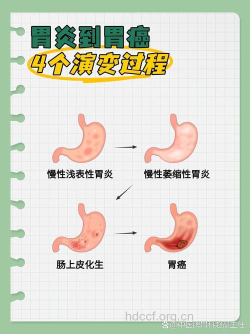 胃炎怎么发展成胃癌