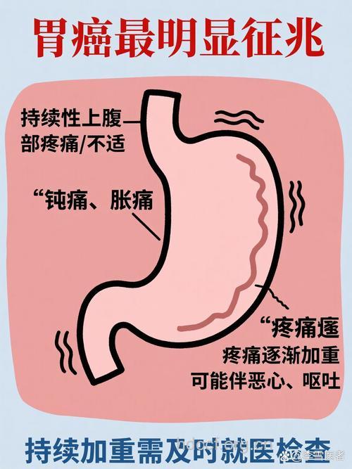 胃癌常见的症状表现