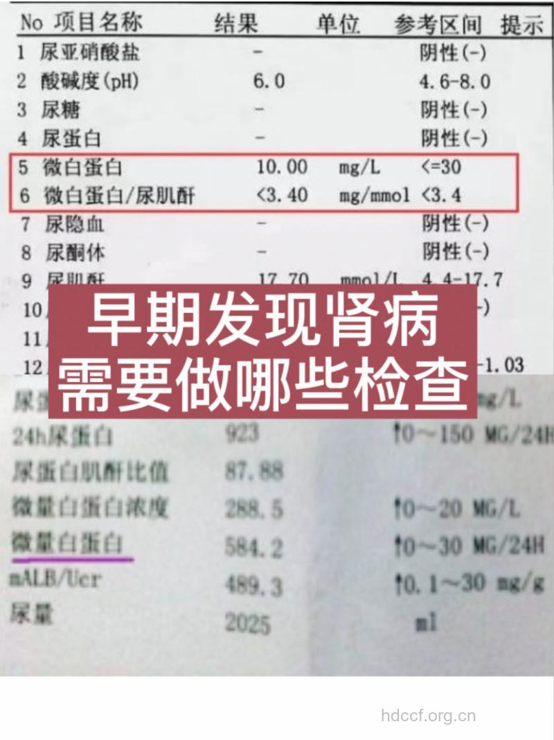 哪些常规项目检查可以发现肾病？