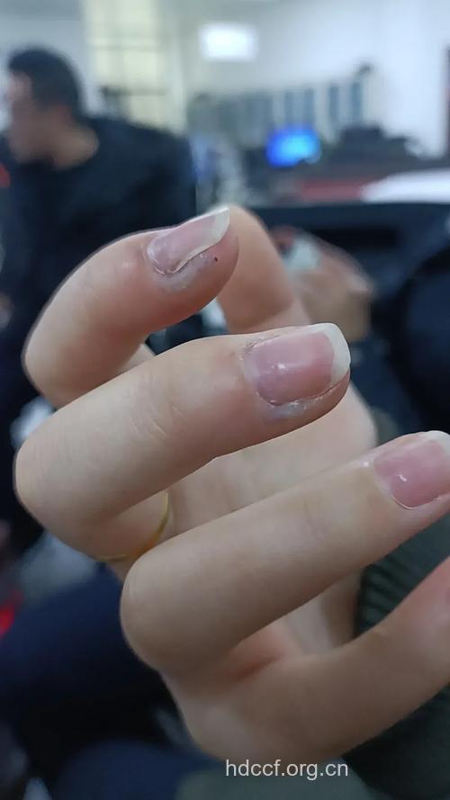 美甲可能感染乙肝吗？