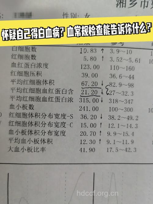 血常规可以检查出白血病吗？