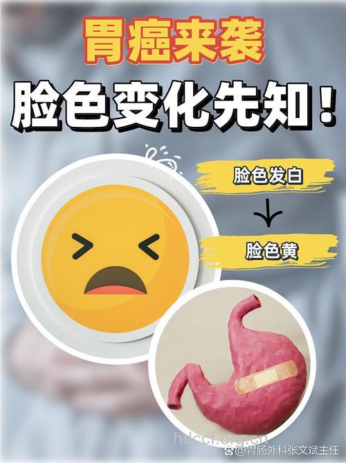晚期胃癌患者有贫血吗