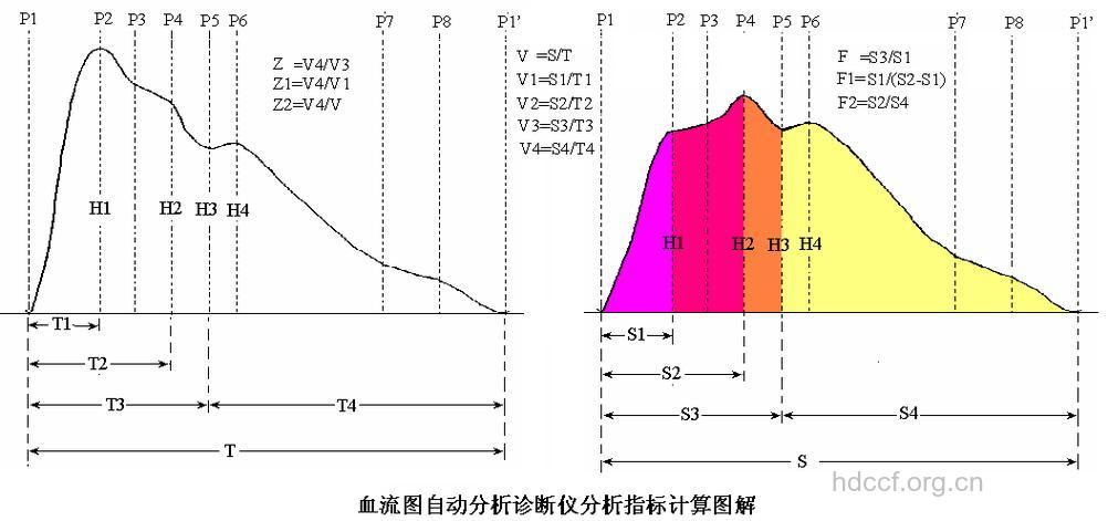 脑阻抗血流图检查简单易行